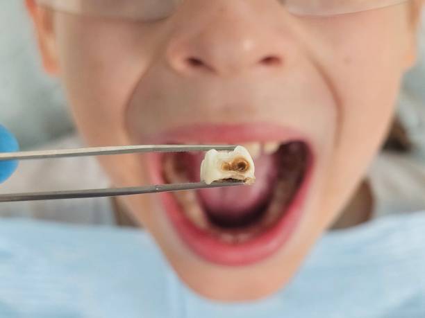 Best After-Hours Dental Care in Woodsboro, TX